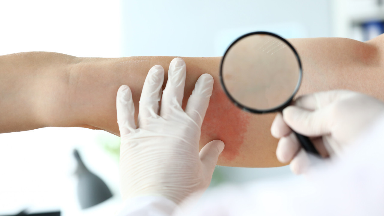 ciltte gorulen basit bir dokuntu bize cok sey anlatiyor olabilir TTObd1iR.jpg